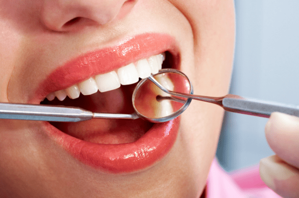 Dental Treatments Gallery