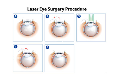 Role of Laser Treatments